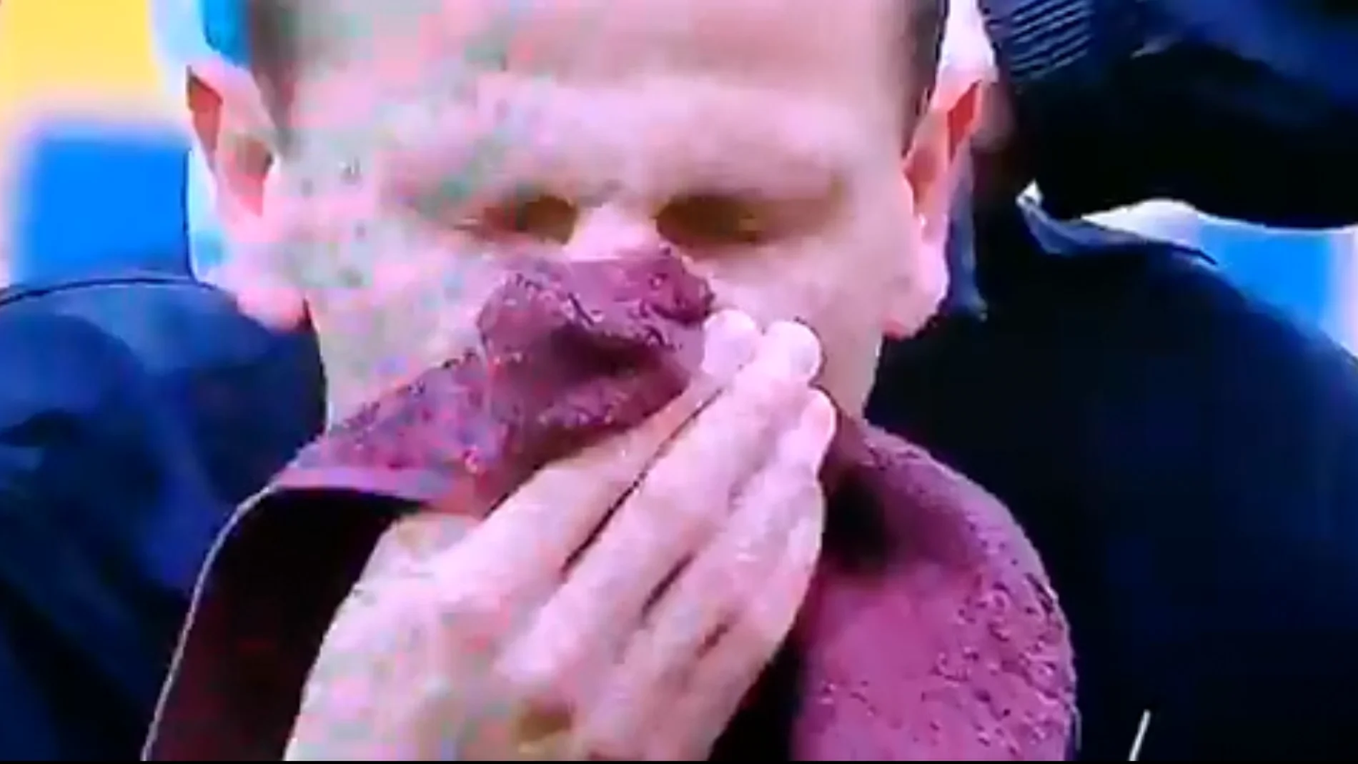 Maciej Dabrowski del LKS Lodz se rompe la nariz haciendo una chilena Maciej Dabrowski del LKS Lodz se rompe la nariz haciendo una chilena