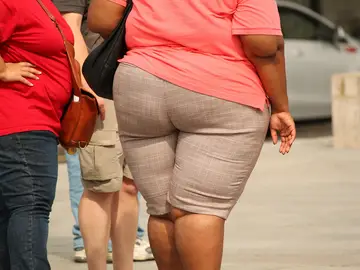 personas con obesidad personas con obesidad