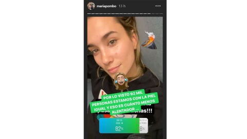 María Pombo enseña sus granitos 