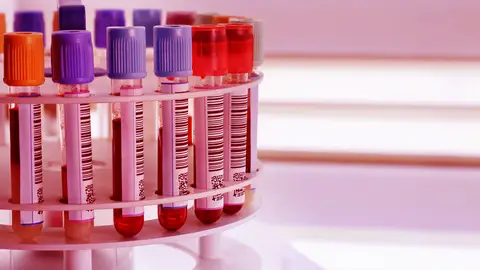 El tipo de sangre puede protegernos frente al coronavirus Coronavirus