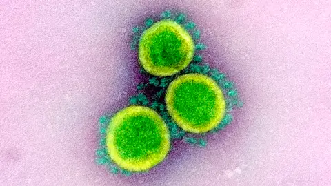 La OMS confirma que el coronavirus no viaja libremente por el aire sino en gotas La OMS confirma que el coronavirus no viaja libremente por el aire sino en gotas