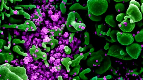 Imagen de un virus visto con el microscopio. Coronavirus microscopio