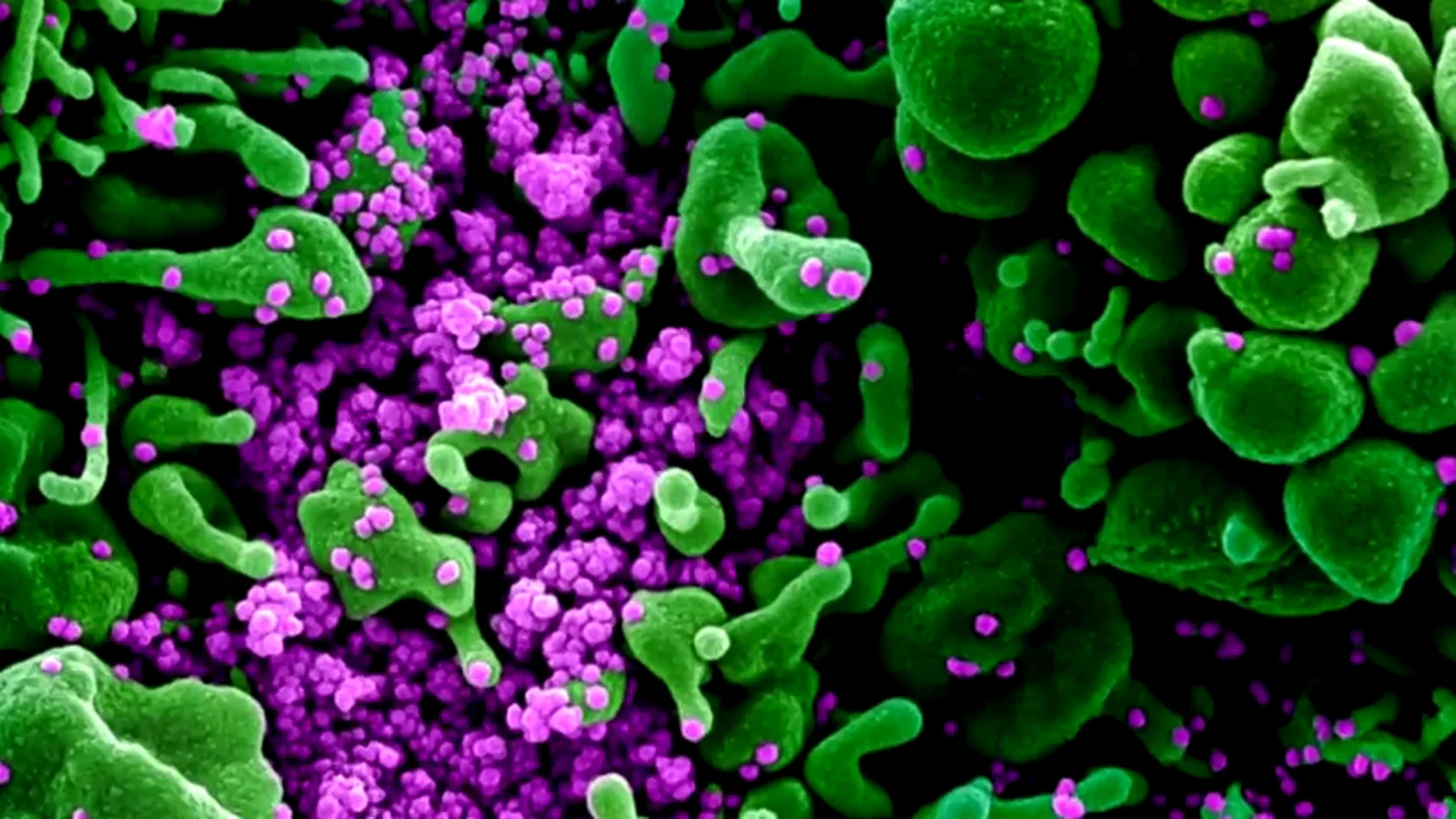 Imagen de un virus visto con el microscopio.