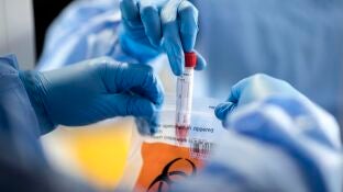 Las muestras de sangre no son necesarias para el diagn&oacute;stico de coronavirus mediante este innovador m&eacute;todo