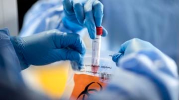 Las muestras de sangre no son necesarias para el diagnóstico de coronavirus mediante este innovador método