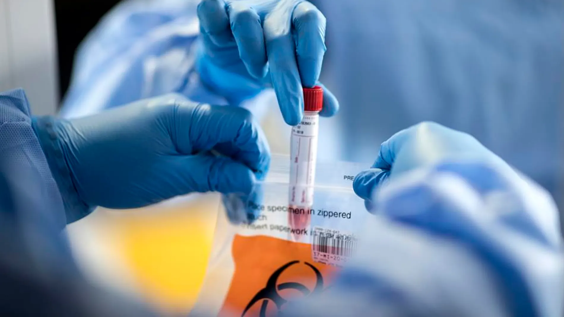 Las muestras de sangre no son necesarias para el diagnóstico de coronavirus mediante este innovador método Las muestras de sangre no son necesarias para el diagnóstico de coronavirus mediante este innovador método