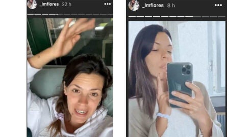 Laura Matamoros y su grano en la barbilla