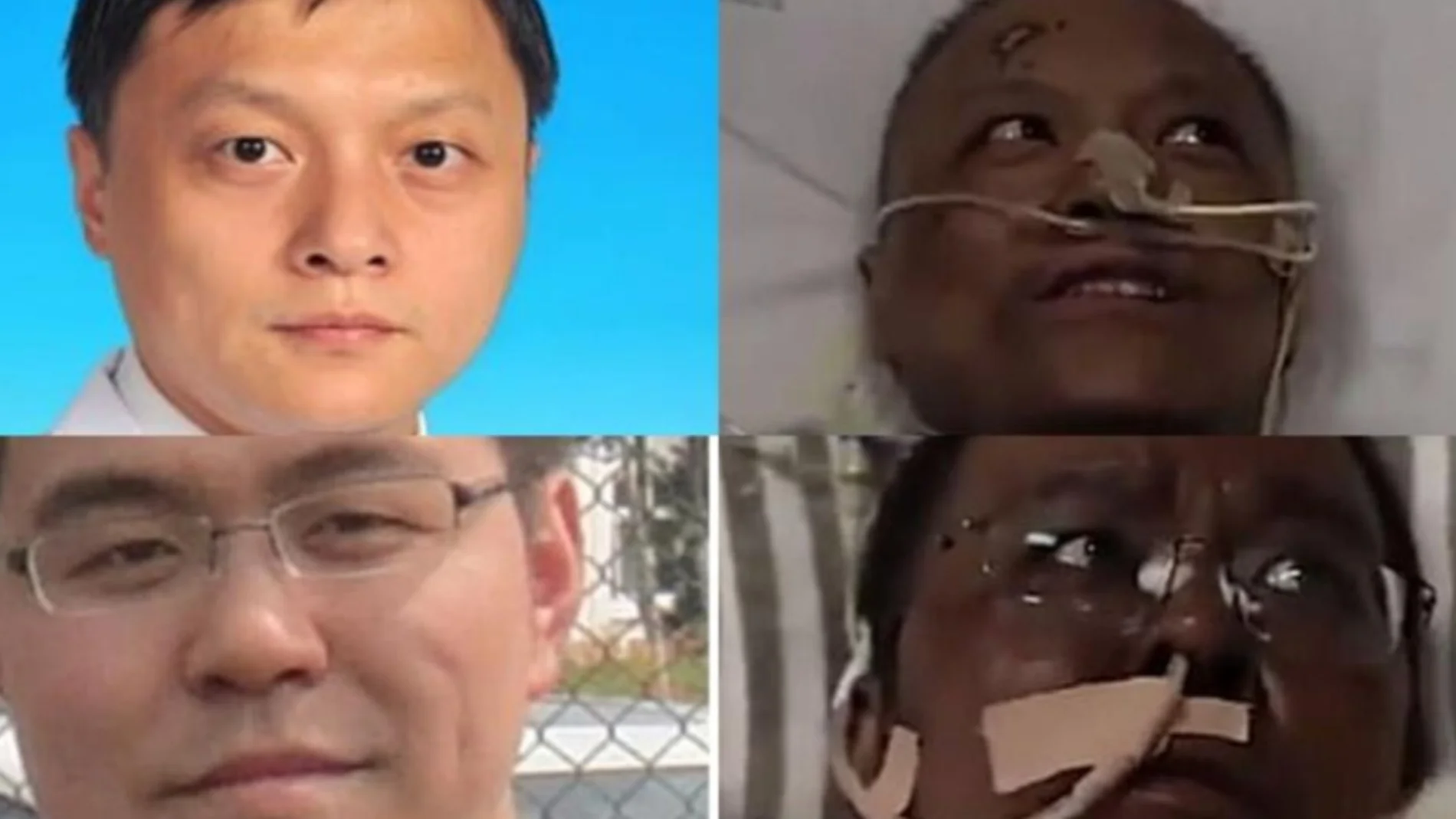 Yi Fan y Hu Weifeng experimentaron un extraño cambio de pigmentación tras superar el coronavirus Yi Fan y Hu Weifeng experimentaron un extraño cambio de pigmentación tras superar el coronavirus