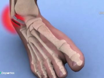 LESIONESCONFIN