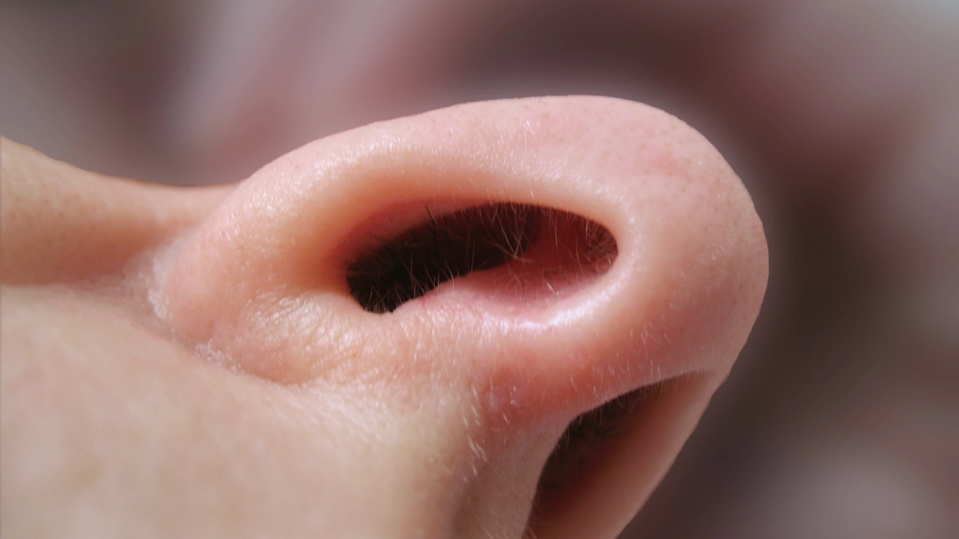 Una prueba de olfato predice la evolucion de pacientes con lesiones cerebrales graves Una prueba de olfato predice la evolucion de pacientes con lesiones cerebrales graves