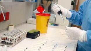 Imagen de un ensayo cl&iacute;nico en un laboratorio