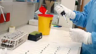 Imagen de un ensayo clínico en un laboratorio Imagen de un ensayo clínico en un laboratorio