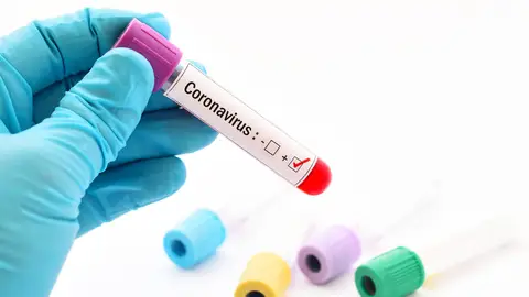 Positivo en coronavirus Positivo en coronavirus