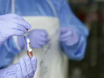 Muestra de coronavirus de un laboratorio. Muestra de coronavirus de un laboratorio.