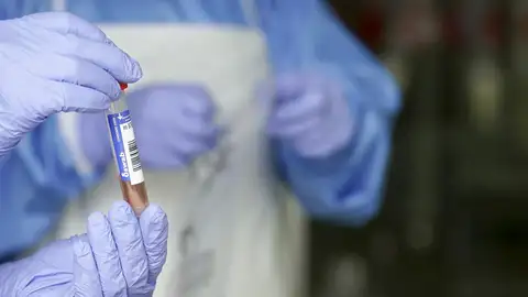 Muestra de coronavirus de un laboratorio. Muestra de coronavirus de un laboratorio