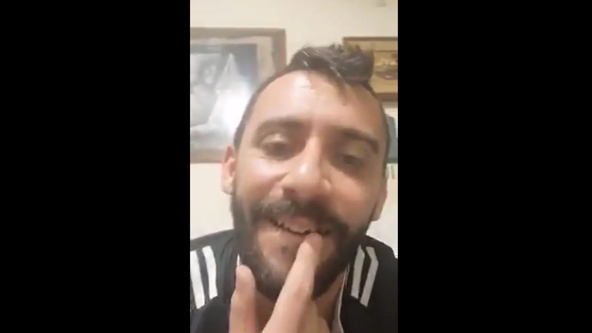 Álvaro Fernández muestra su diente roto en redes Álvaro Fernández muestra su diente roto en redes