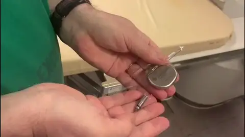 Se implanta un marcapasos sin cables en el Hospital de Santiago, en una operación pionera en Europa Se implanta un marcapasos sin cables en el Hospital de Santiago, en una operación pionera en Europa