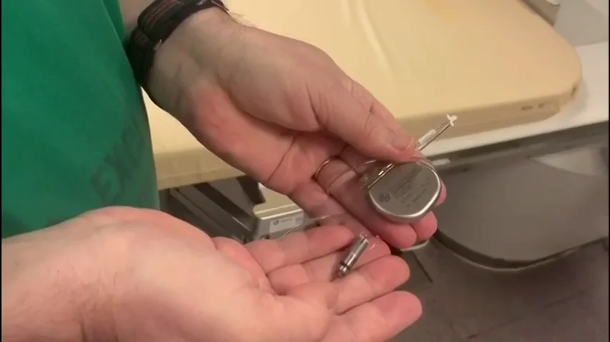 Se implanta un marcapasos sin cables en el Hospital de Santiago, en una operación pionera en Europa Se implanta un marcapasos sin cables en el Hospital de Santiago, en una operación pionera en Europa
