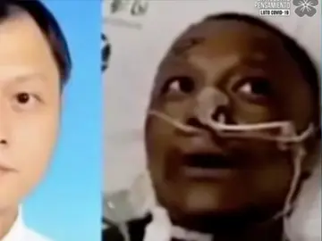 Cambio tono de piel Cambio tono de piel