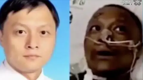 Cambio tono de piel Cambio tono de piel