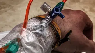 Imagen de Dani Rovira durante su sexta sesión de quimioterapia Imagen de Dani Rovira durante su sexta sesión de quimioterapia