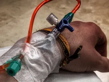 Imagen de Dani Rovira durante su sexta sesión de quimioterapia Imagen de Dani Rovira durante su sexta sesión de quimioterapia