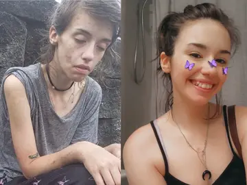 La fotografía que muestra la transformación de Amber Hoffman La fotografía que muestra la transformación de Amber Hoffman