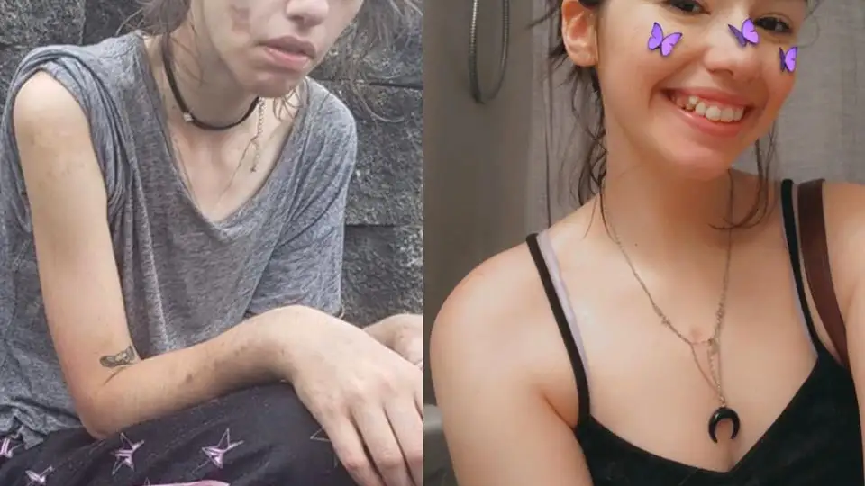 La fotograf&iacute;a que muestra la transformaci&oacute;n de Amber Hoffman
