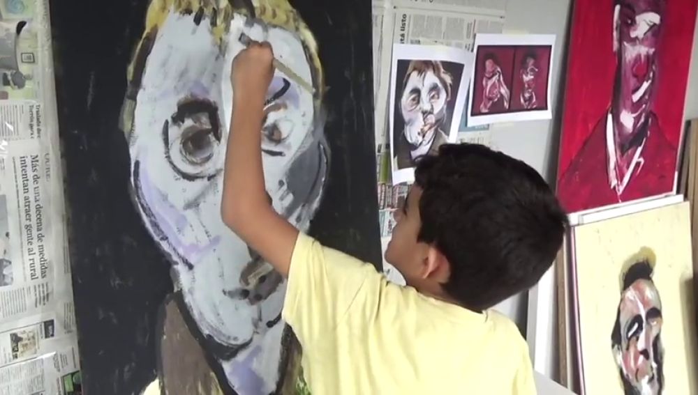 Hugo, un pequeño artista que lucha contra la enfermedad de Dent