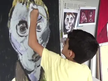 Hugo, un pequeño artista que lucha contra la enfermedad de Dent Hugo, un pequeño artista que lucha contra la enfermedad de Dent