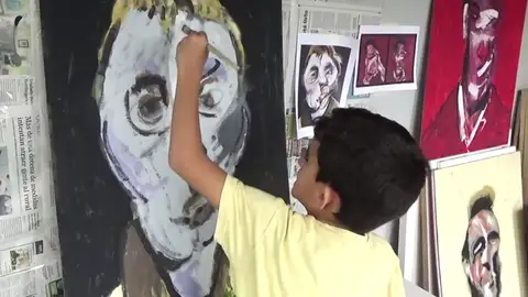 Hugo, un pequeño artista que lucha contra la enfermedad de Dent Hugo, un pequeño artista que lucha contra la enfermedad de Dent