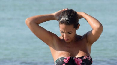 El extraño bulto de Tamara Gorro en la rodilla: 