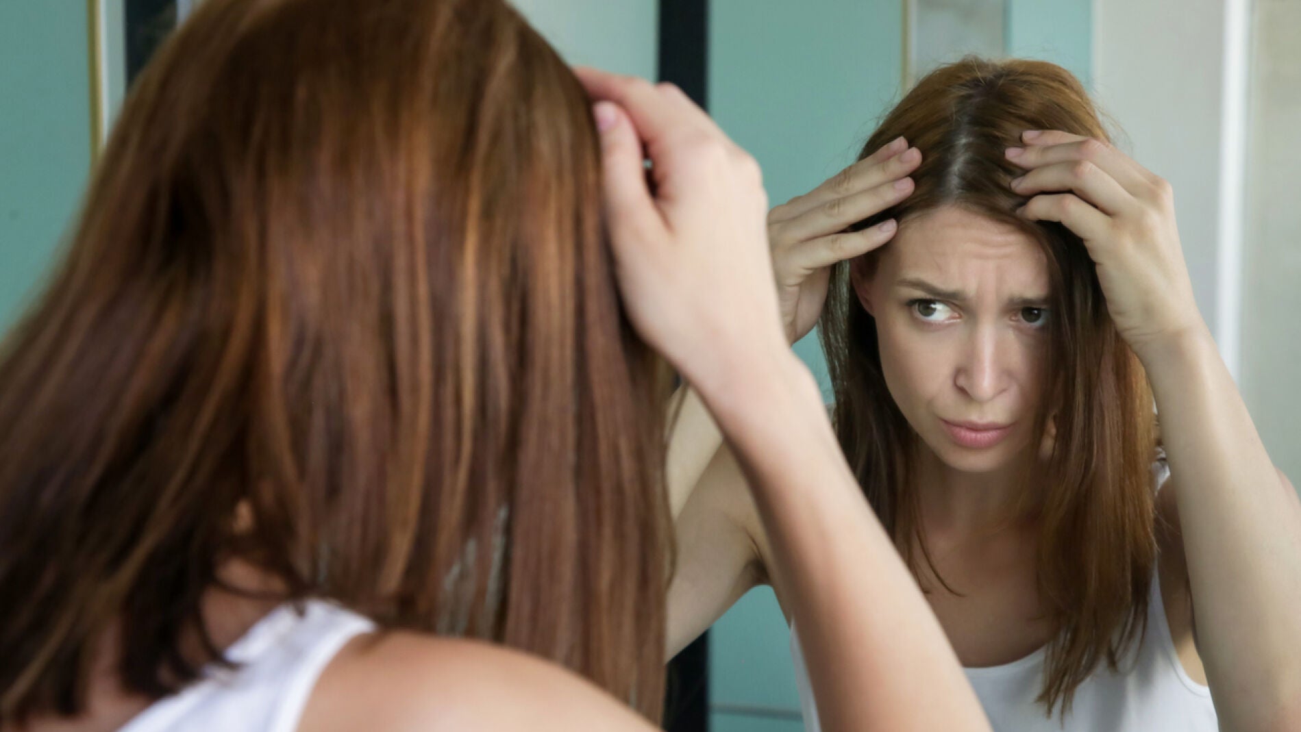 Alopecia