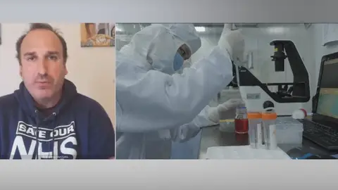 Voluntario español que prueba vacuna contra el coronavirus en Oxford coronavirus