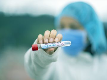 Una muestra de un test de Covid19