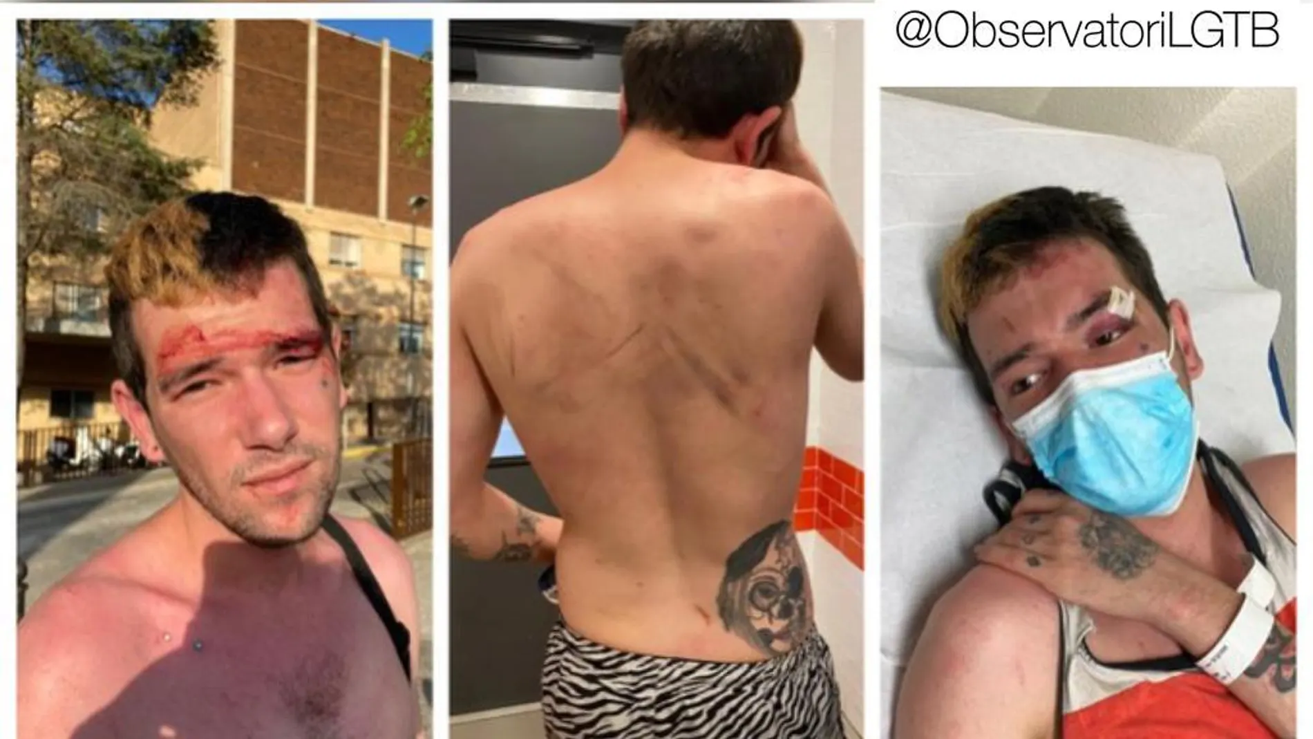 El joven tras ser presuntamente agredido El joven tras ser presuntamente agredido