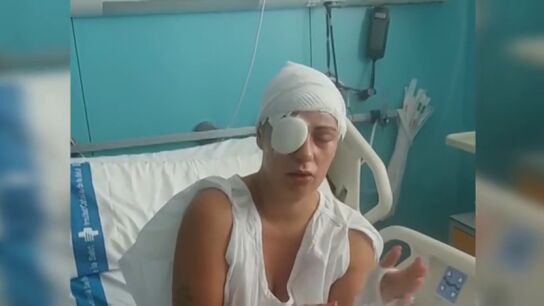 El testimonio de la mujer quemada con sosa c&aacute;ustica en Girona: "Hasta que no lo ha hecho..."