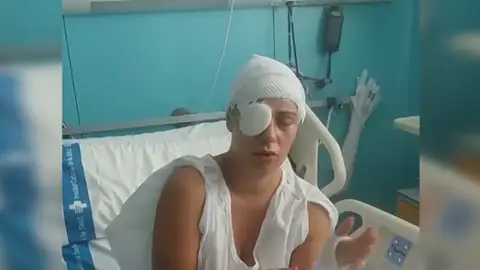 El testimonio de la mujer quemada con sosa cáustica en Girona: "Hasta que no lo ha hecho..." El testimonio de la mujer quemada con sosa cáustica en Girona: "Hasta que no lo ha hecho..."