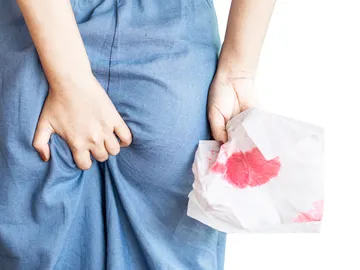 Sangrado anal Sangrado anal