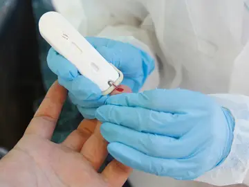 Prueba del coronavirus Prueba del coronavirus