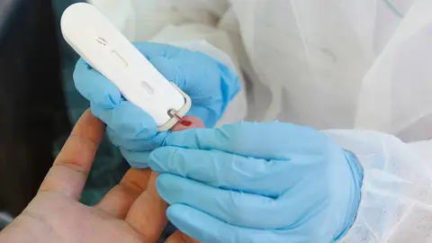 Prueba del coronavirus Prueba del coronavirus