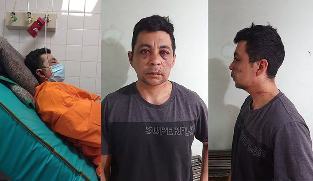 Daniel Porro, el enfermero agredido 