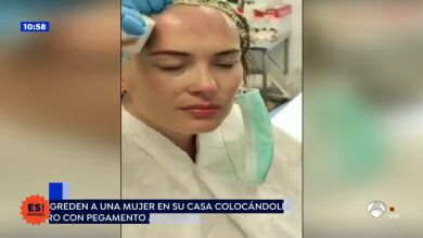 Agredida con un gorro de pegamento abrasivo cuando abría la puerta de su casa en Valencia