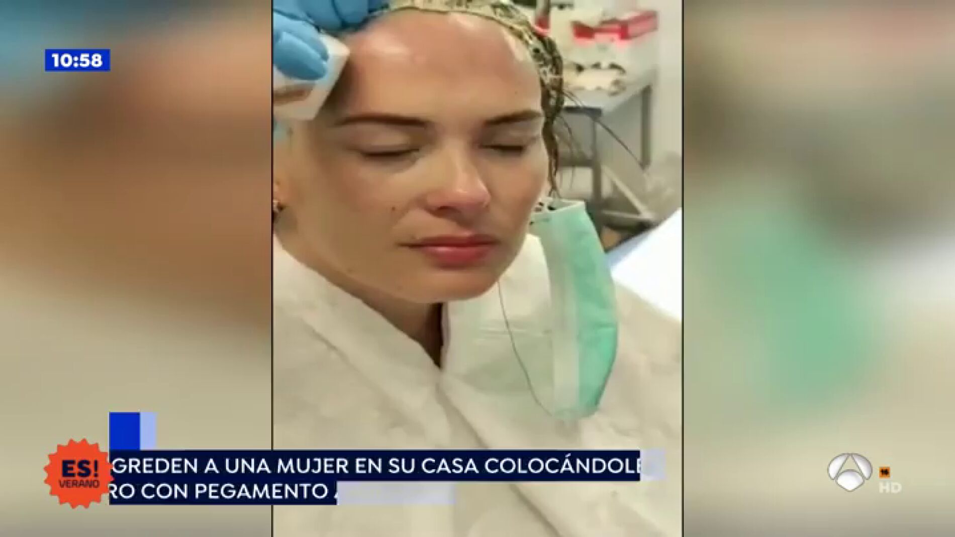 Agredida con un gorro de pegamento abrasivo cuando abr&iacute;a la puerta de su casa en Valencia