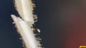Marc Márquez comparte en Instagram la imagen de su húmero roto 