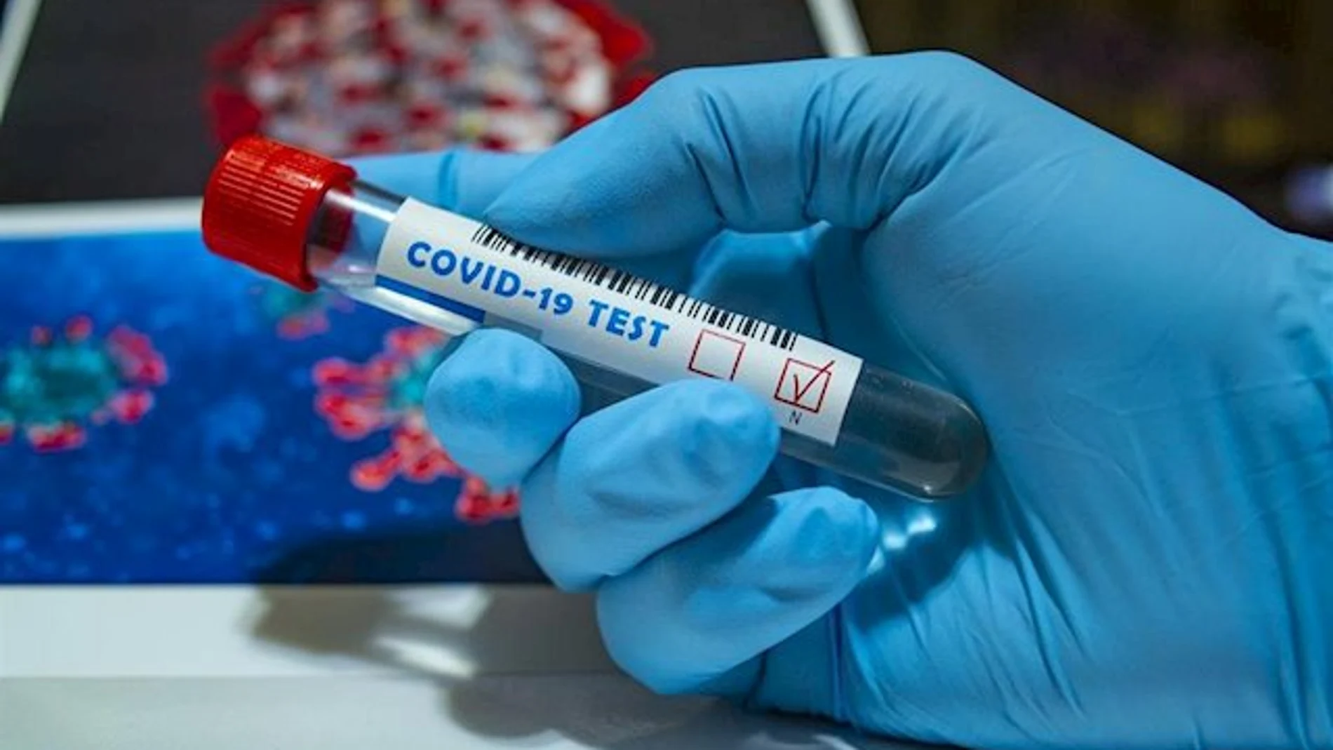 Prueba Coronavirus Prueba Coronavirus