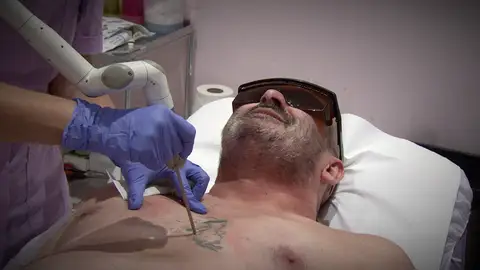 El duro proceso de Paco: eliminar los 19 tatuajes que tiene en todo el cuerpo El duro proceso de Paco: eliminar los 19 tatuajes que tiene en todo el cuerpo