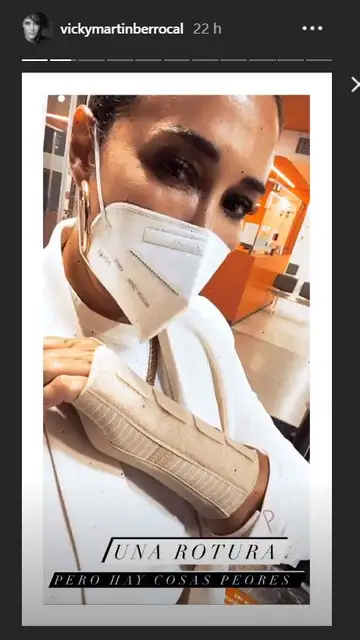 Vicky Martín Berrocal enseña su brazo Vicky Martín Berrocal enseña su brazo