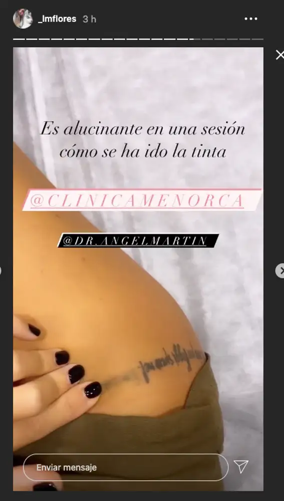 Así se elimina Laura Matamoroso el tatuaje del que tanto se arrepiente 
