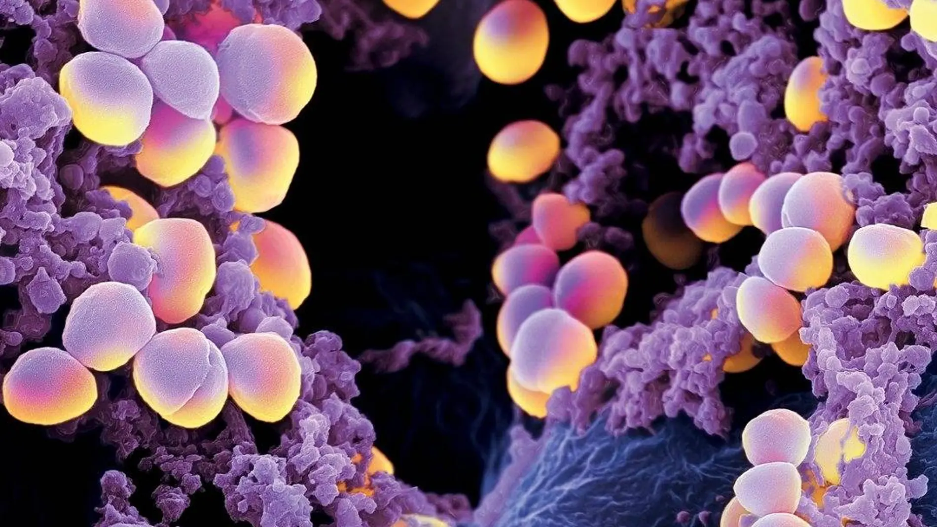 Imagen de bacterias